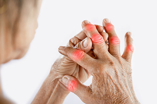 woman hand suffering from joint pain